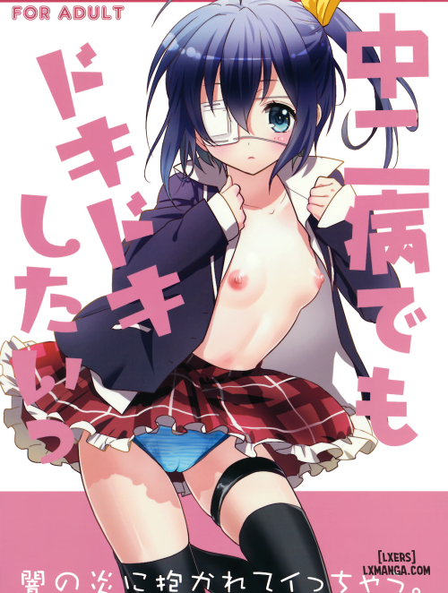 chuunibyou-demo-dokidoki-shitai